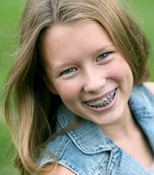 stock photo of a girl wearing braces